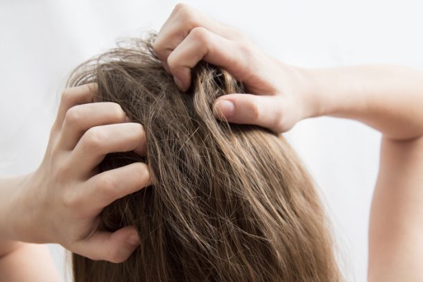 The Right Way to Deal With Dandruff - FabFitFun
