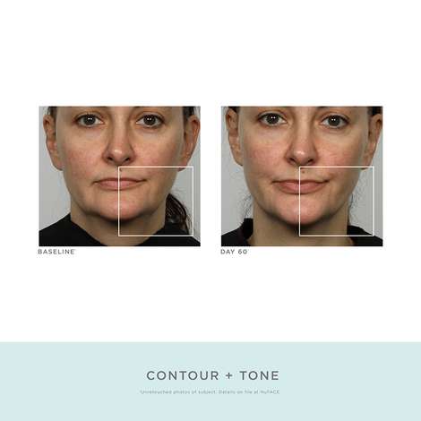 NuFACE Refreshed Trinity Face Toning Device + $30 Credit - FabFitFun