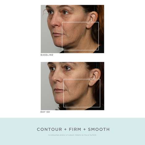 NuFACE Refreshed Trinity Face Toning Device + $30 Credit - FabFitFun
