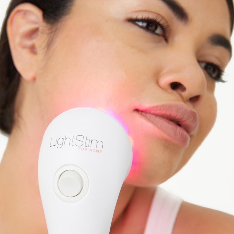 LightStim® for Acne