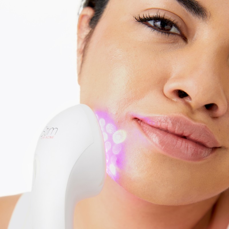 LightStim® for Acne
